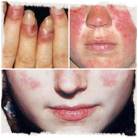 primer departamento dermatologo