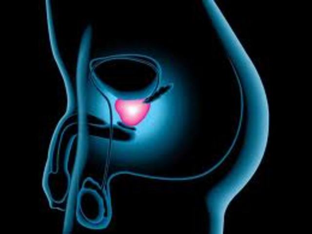 CONTRA EL CANCER DE PROSTATA
