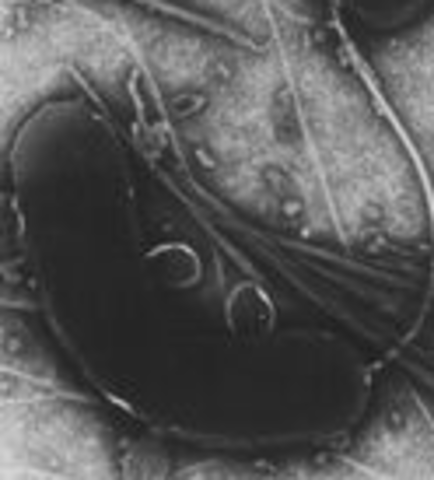 Cholera Bacteria Discoverd