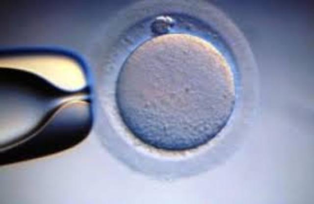 Potter en entrevista con REICH