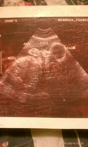 Ultrasound while in womb