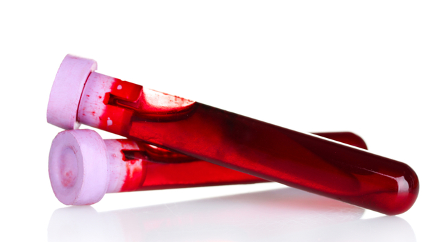 Had not discovered the Rh factor, or erythrocyte antigens