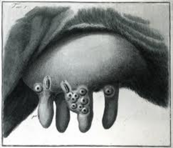 Edward Jenner Cowpox