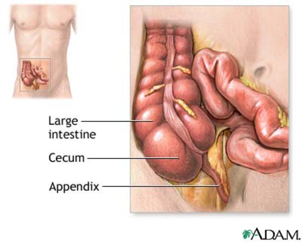 First appendectomy