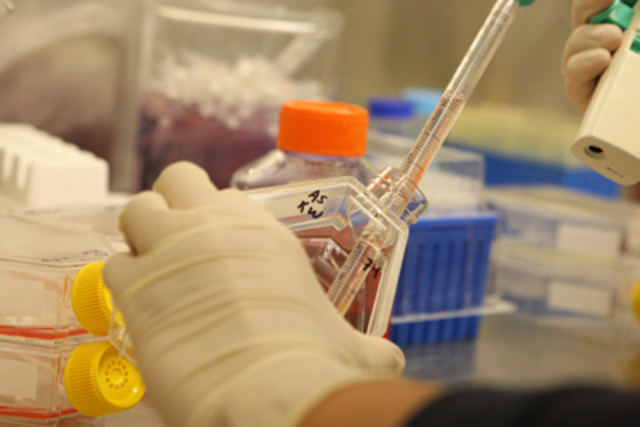 Mthod to protect peopel from smallpox