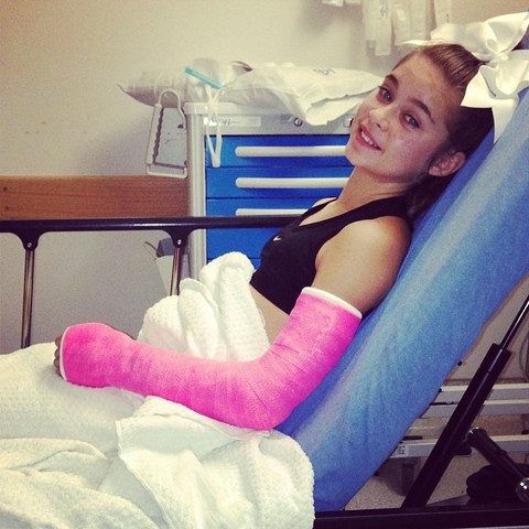 The first bone I broke