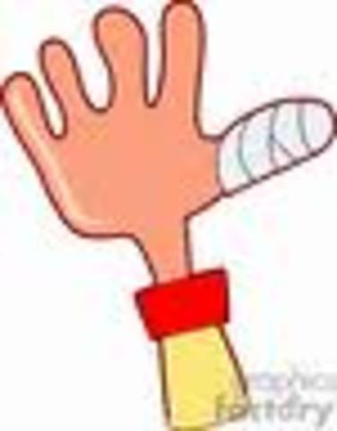 Cuando me rompÍ mi pulgar