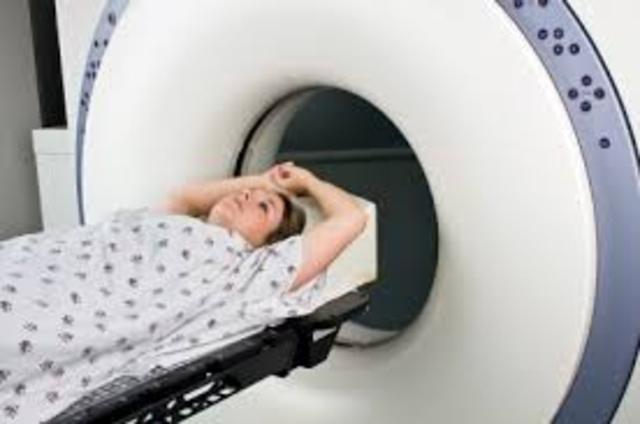 Primera deteccion de RM