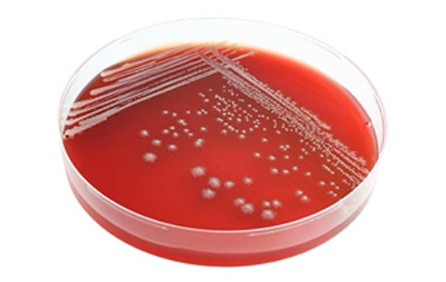 Penicillin was invented