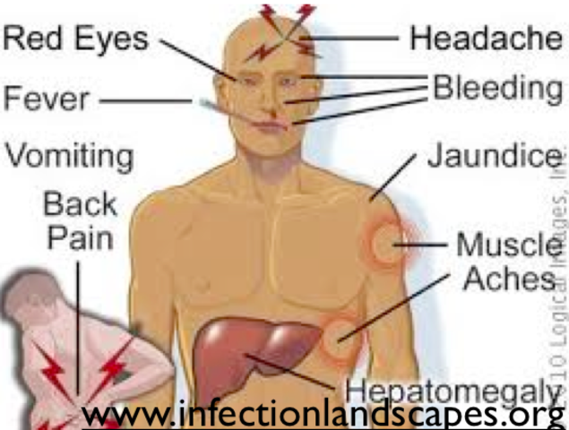 Yellow Fever Outbreak in Philidelphia