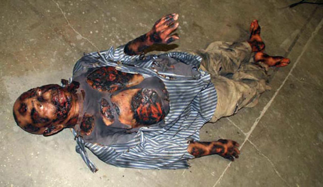 First dissection of human corpse.