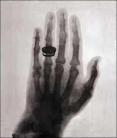 Wilhelm Conrad Roentgen discovers X rays