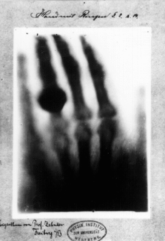 William Roentgen Discovers X-rays
