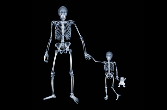 Discovering the XRay