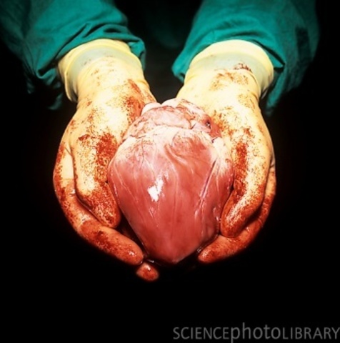 Christian Barnard performed the world's first heart transplant surgery