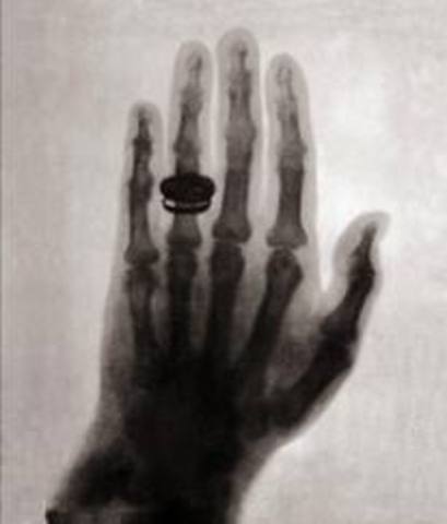 William Roentgen discovered X-Ray