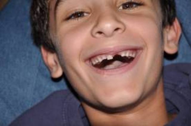 Perdí mí primer diente en 2005