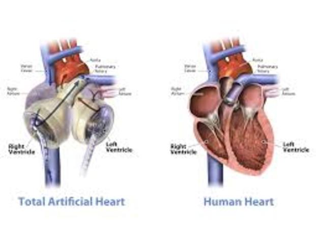 Artificial Heart