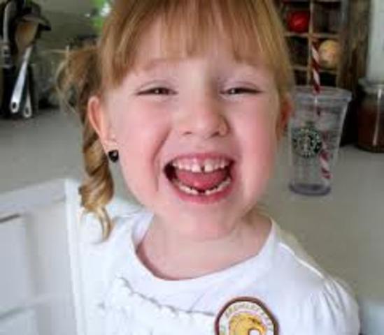 Perdí mi primer diente