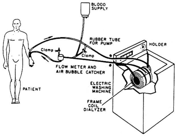 The Introduction of Home Hemodialysis
