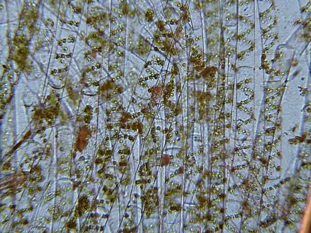 Leowenhoek: Linving Cells