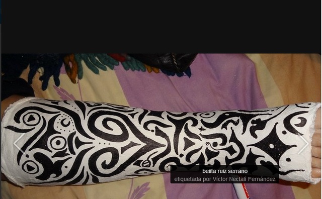 Accidente en patines en el parque del Retiro