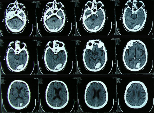 Computed tomography would not have invented, then could not get sections of anatomical objects diagnostic purposes.