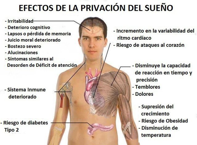 No dormir lo nesesario