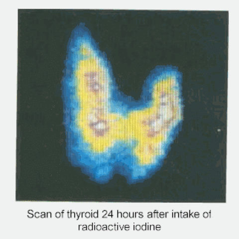 Radioactive Iodine Experiments