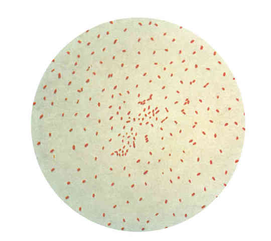 Whooping Cough Experiment