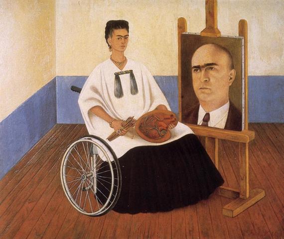 Frida had her leg amputated right below her knee due to having polio in her right leg.