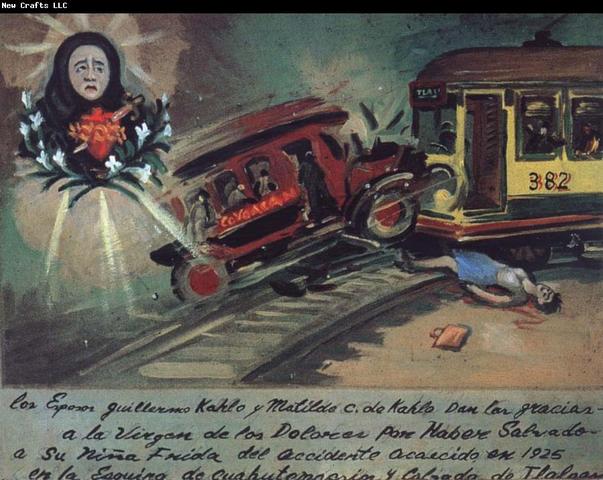A tragic bus accident caused Frida to suffer from seveval injuries.