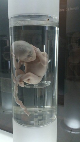 FETO DE 15 A 16 SEMANAS