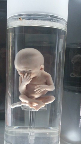 DE LA SEMANA 17 A 20