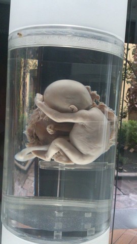 FETO A LAS 22 SEMANAS