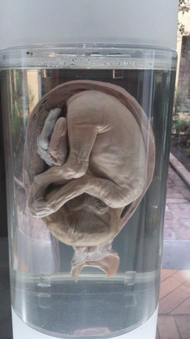 FETO DE 26 A 29 SEMANAS