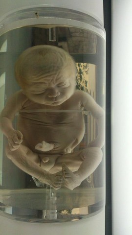 FETO DE 30 A 38 SEMANAS