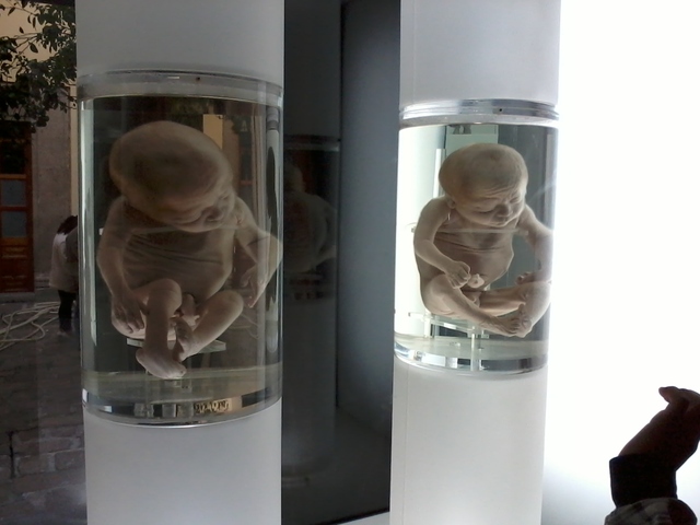 Fetos de 30 a 38 semanas