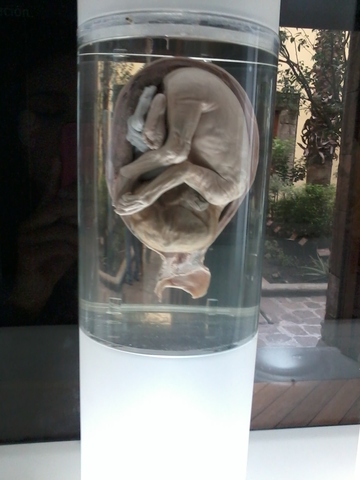 Feto de 26 a 29 semanas