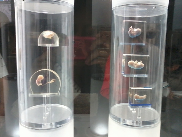 Embriones de 8 y 9 semanas