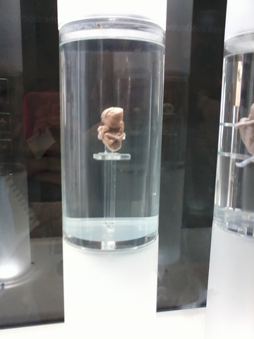 Etapa Fetal.Feto 12 semanas