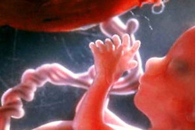 Desarrollo del feto- Semana 15