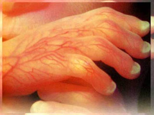 Desarrollo del feto-21 semanas