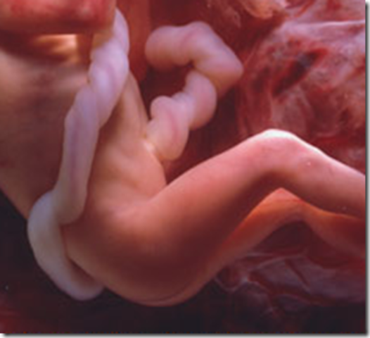 Desarrollo del feto- 28 semanas