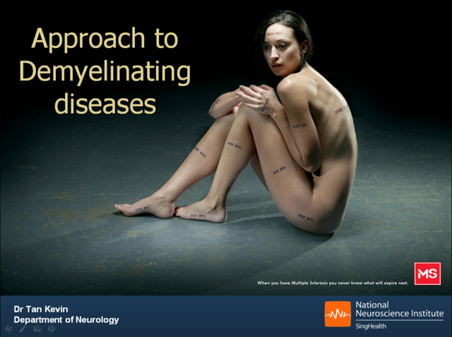 17. Approach to Demyelinating Diseases