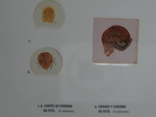 cerebro