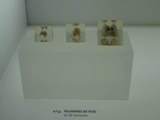 Pulmones