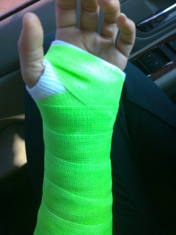 Broke Wrist
