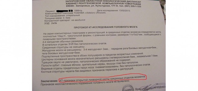 Помилка в діагнозі ледь заживо не поховала молоду дівчину