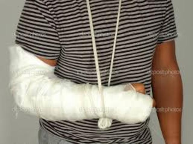 Broken arm